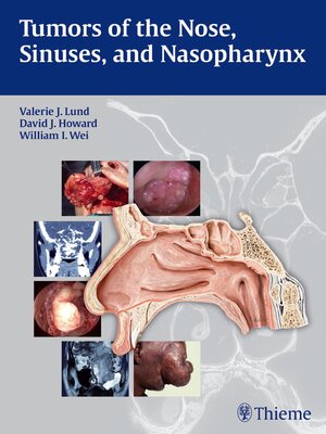 cover image of Tumors of the Nose, Sinuses and Nasopharynx